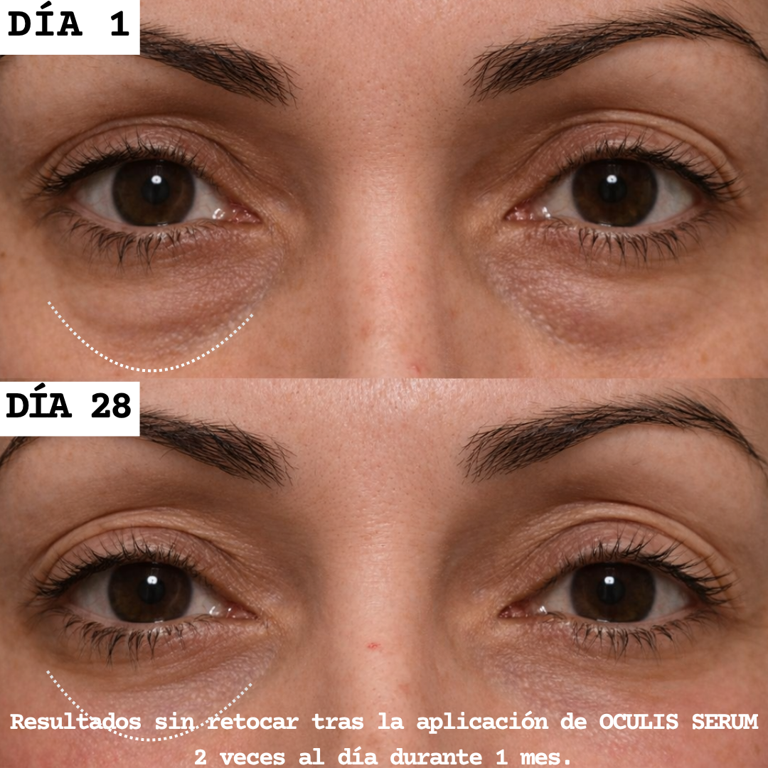 MIRÉA SERÚM · COMBATE BOLSAS & OJERAS