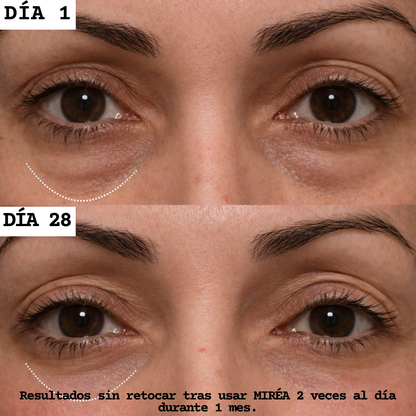 Adiós bolsas & ojeras. Más luz en tu mirada.