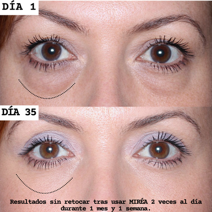 Adiós bolsas & ojeras. Más luz en tu mirada.